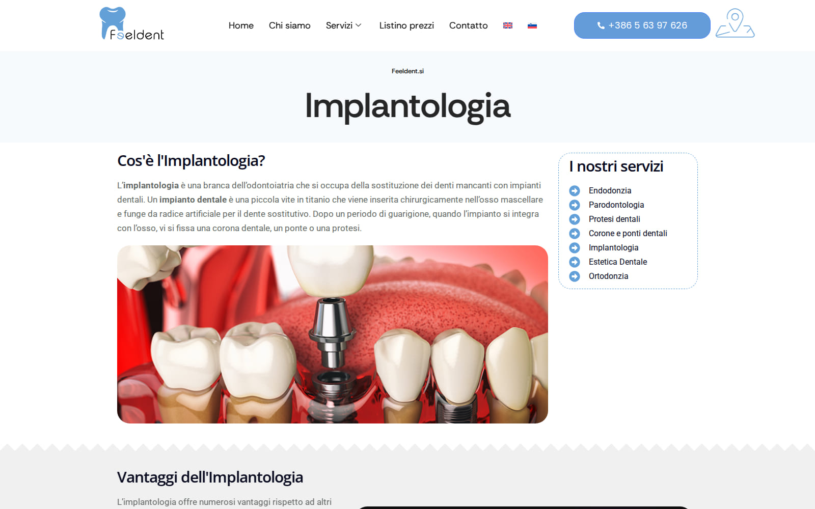 The implantology service page in Italian, headed Implantologia, with an explanation of what a dental implant is and a sidebar listing the clinic's seven services in Italian.